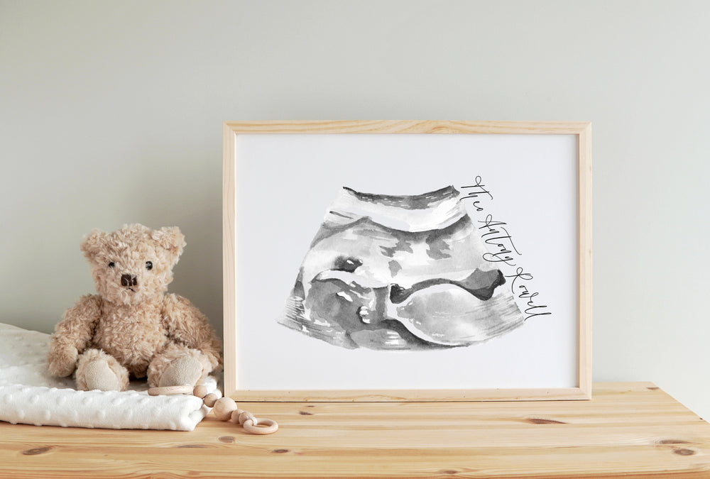 Hand Painted Baby Ultrasound Keepsake